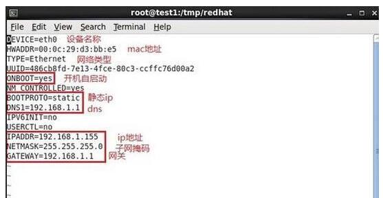 linux的ip如何设置